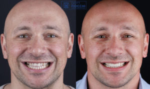 come avere un bel sorriso | Dottor Fiocchi | Studio Dentistico a Milano 