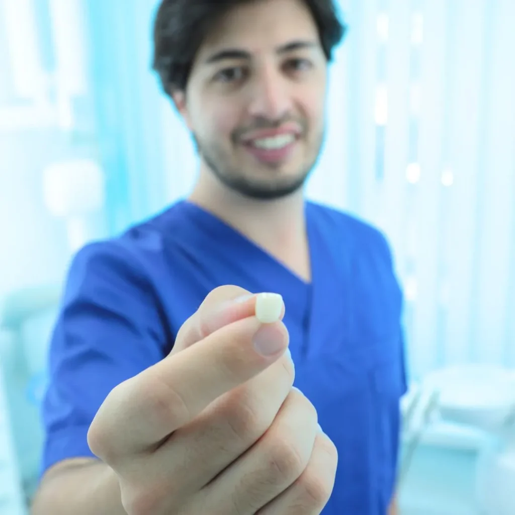 Cosa sono le faccette dentali e quando conviene usarle 2 faccette dentali a Milano Dergano