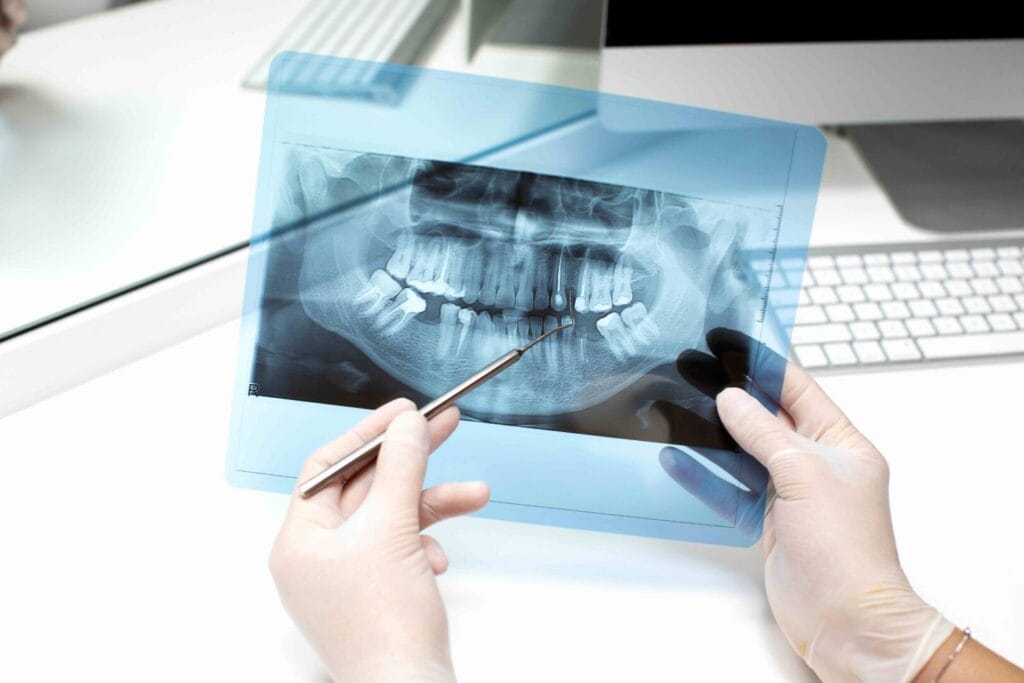 Guida completa implantologia