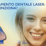 Sbiancamento dentale laser | Dott. Fiocchi