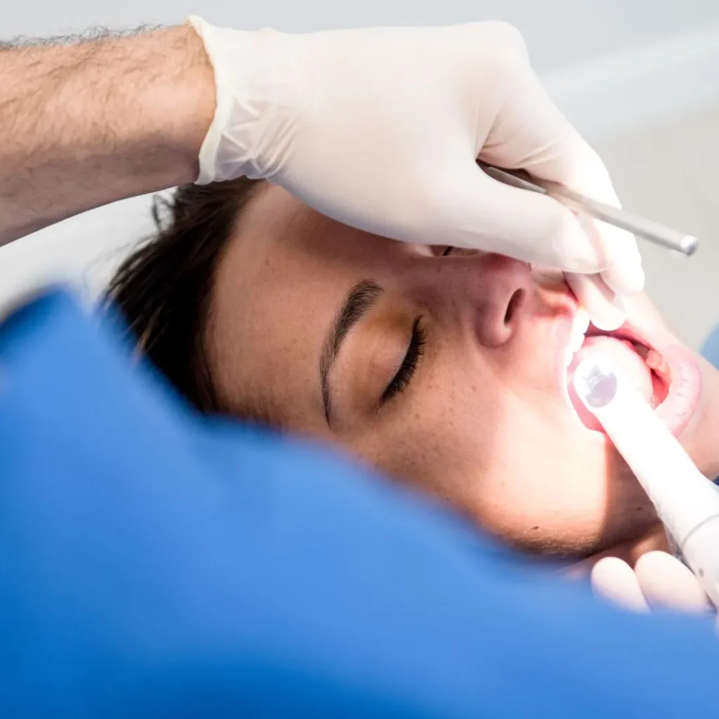 Endodonzia 1 devitalizzazione dente a Milano Dergano