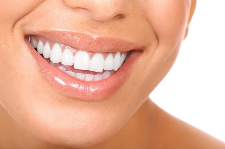 Blog 7 Estetica dentale: come migliorare il sorriso