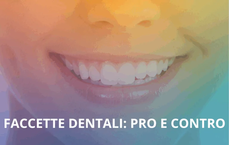 Blog 17 FACCETTE DENTALI PRO E CONTRO