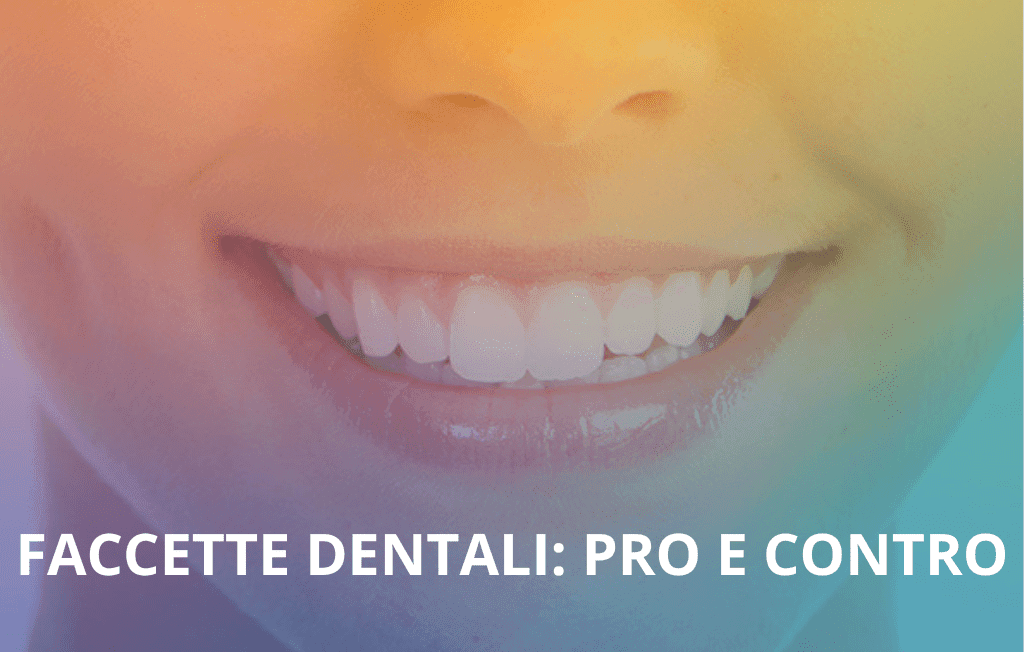 FACCETTE DENTALI PRO E CONTRO