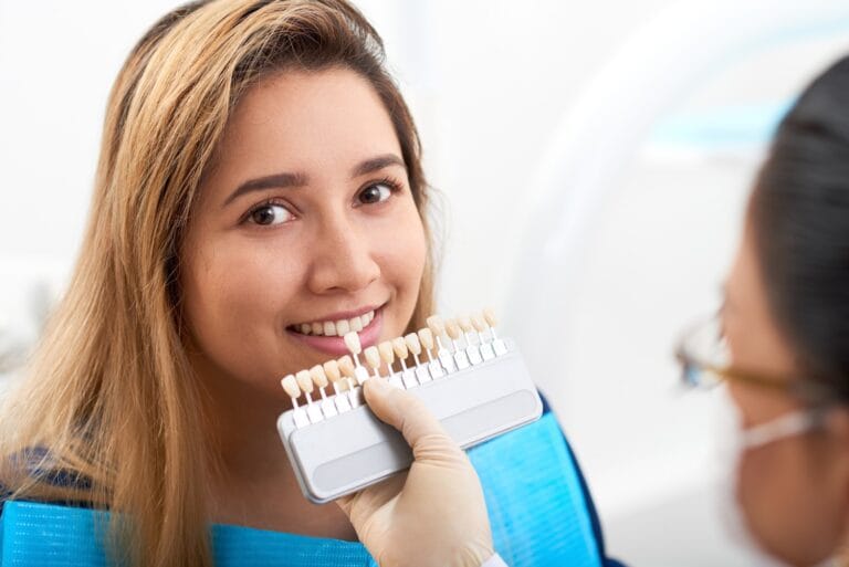 Blog 6 Faccette dentali