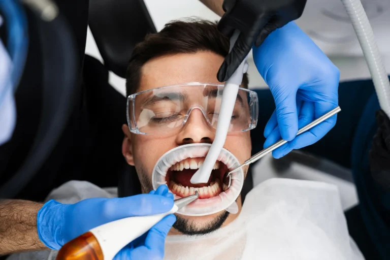 pulizia dentale con Airflow