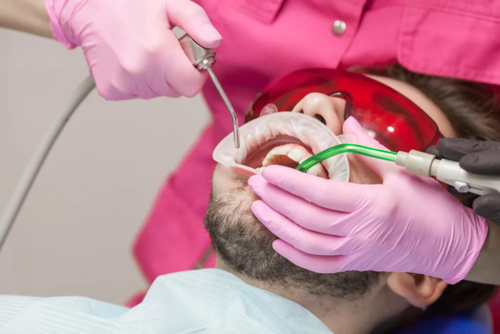 Pulizia dentale e prevenzione gengivite
