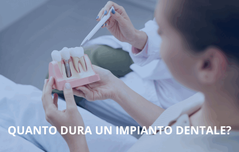 Blog 11 Impianto dentale