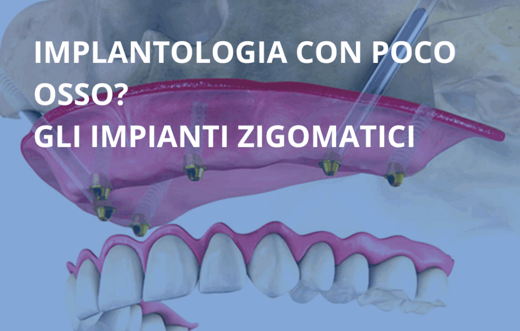 implantologia con poco osso