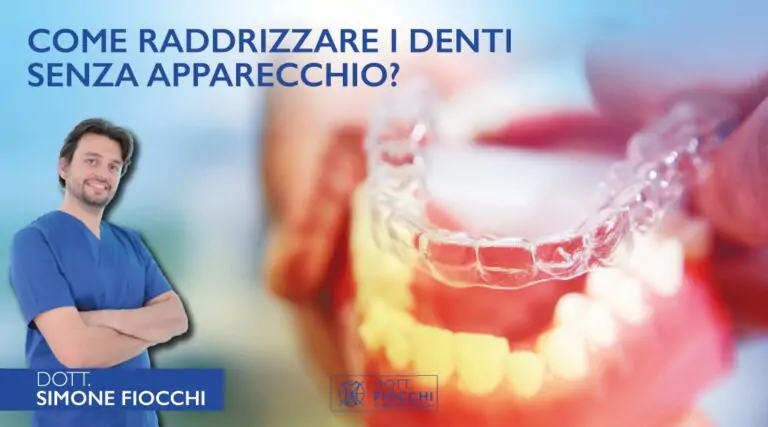 Blog 16 raddrizzare i denti senza apparechio | Dottor Fiocchi | Studio Dentistico a Milano