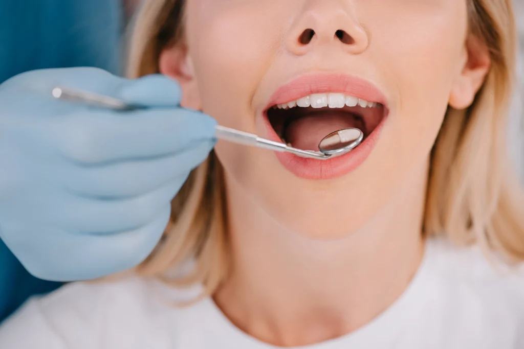 Paura di andare alla prima visita dal dentista: come superarla 2 paura della prima visita dal dentista