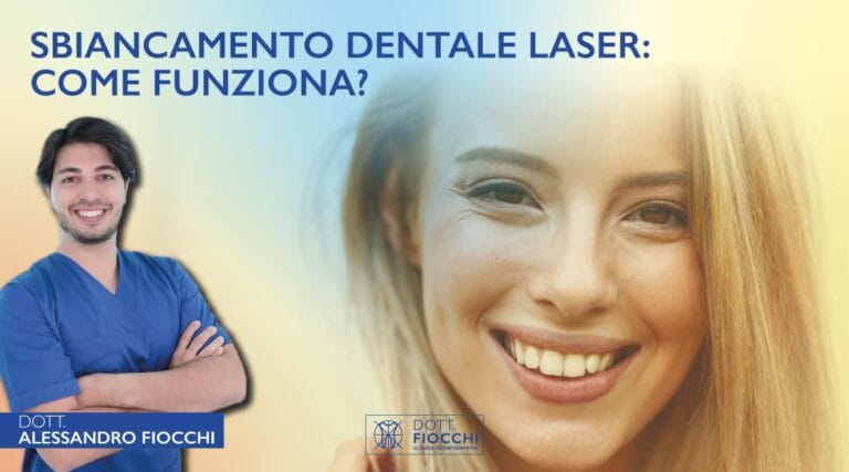Blog 2 Sbiancamento dentale laser | Dott. Fiocchi